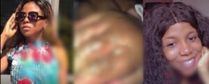 Scandale : Elle brule la main de son bébé pour cette raison