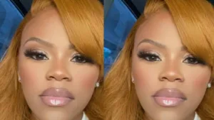 Drame Opération BBL