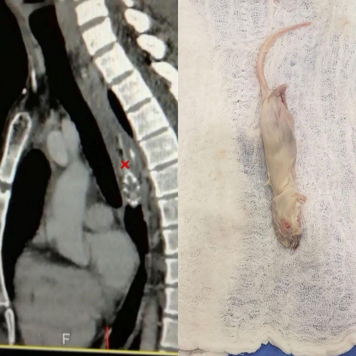 souris extraite oesophage