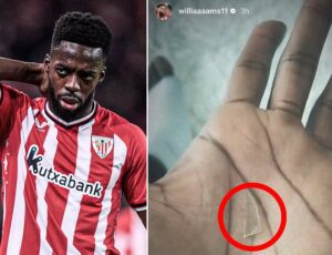 Inaki Williams : L'attaquant ghanéen a joué avec du verre dans le pied pendant 2 ans !