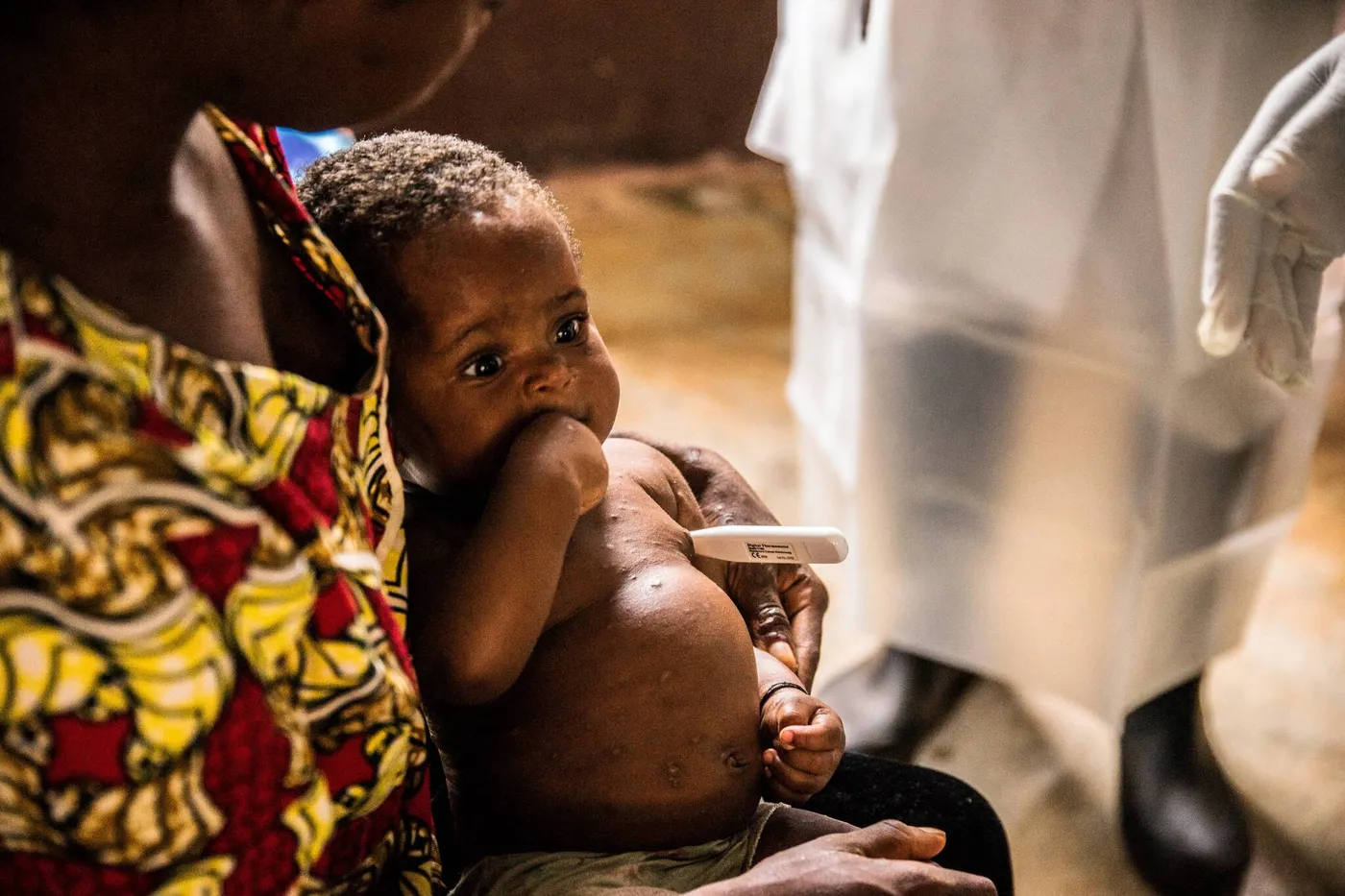 Soins de la peau : Le Togo frappé par une crise silencieuse