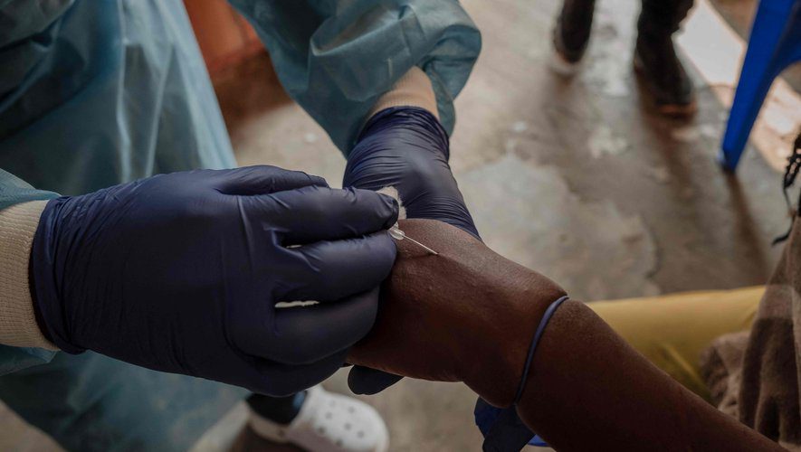 Variole du singe : La RDC annonce le lancement de sa campagne de vaccination anticipée