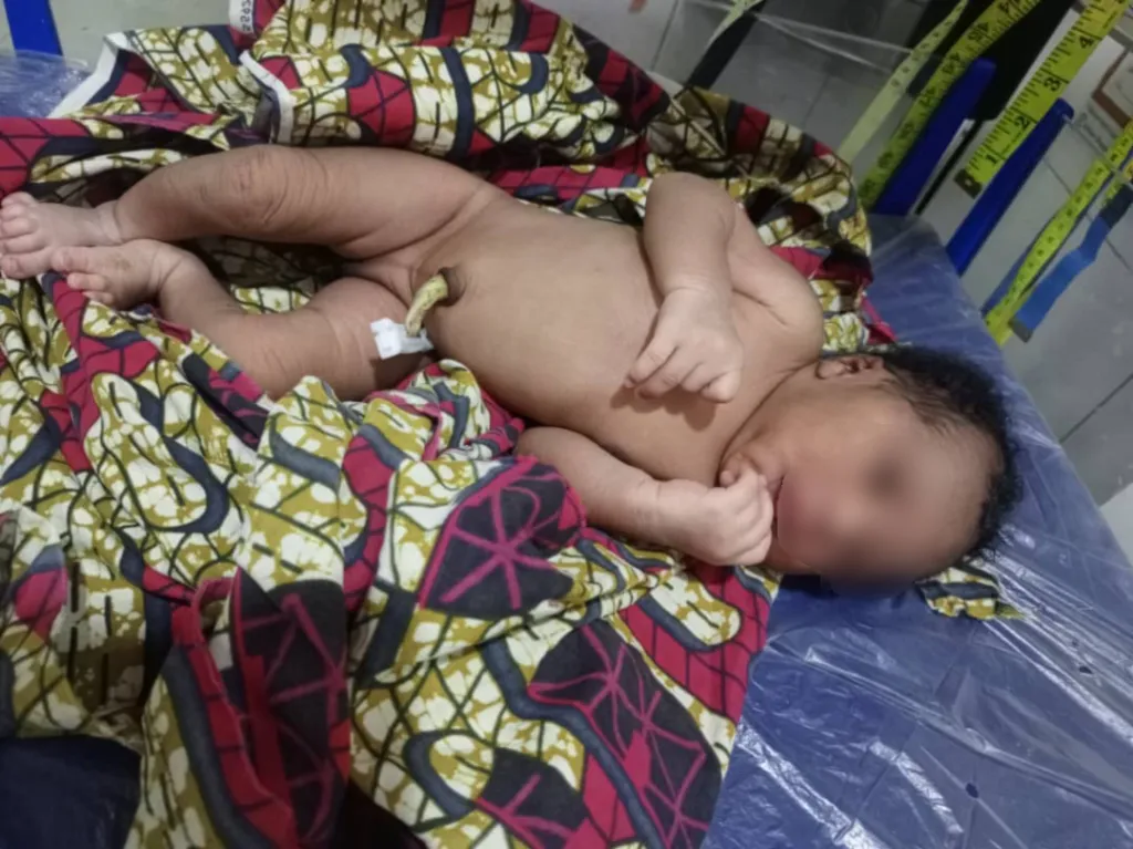 Kara : un nouveau-né retrouvé abandonné sous un abri de Tchoukoutou