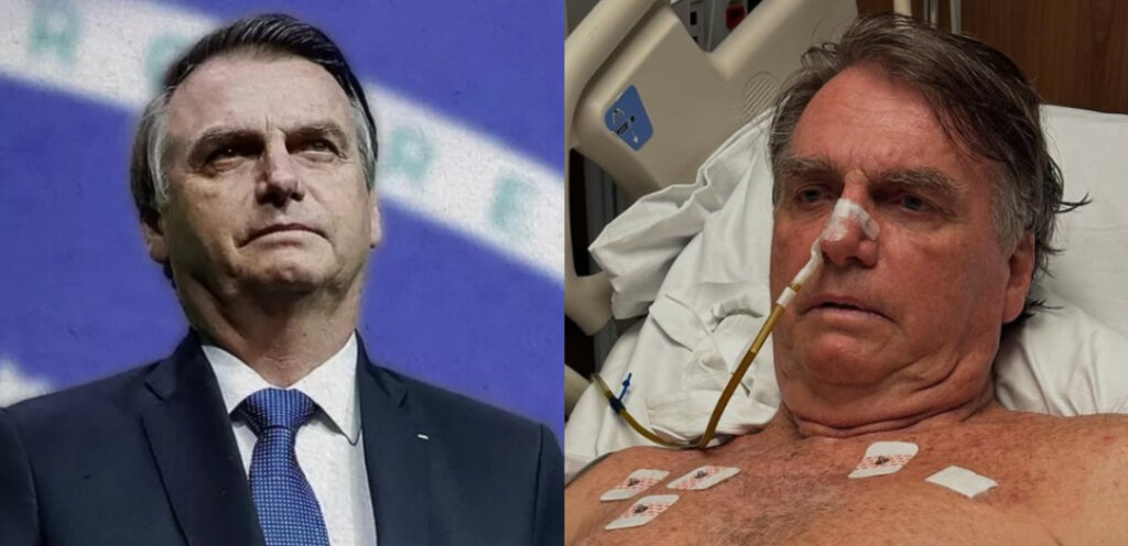 Brésil : L'ex président Jair Bolsonaro dans un état critique