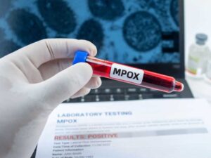 Togo : Deux autres cas de Mpox à Lomé, les autorités sanitaires se mobilisent