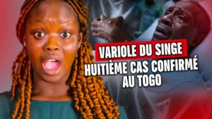 Variole du singe (MPOX) : un huitième cas confirmé au Togo - Revue du 11 juin 2025