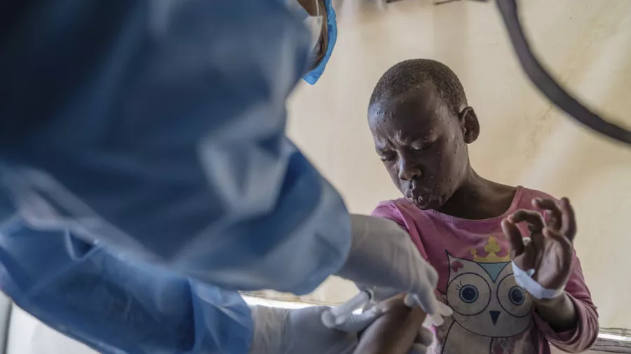 Sénégal : premier cas de Mpox détecté, le gouvernement réagit