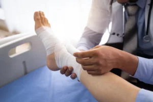 Santé : une "colle osseuse" innovante promet de réparer les fractures en quelques minutes