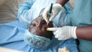 opérations gratuites de la cataracte